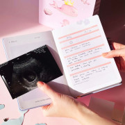 Môj tehotenský denník Albi